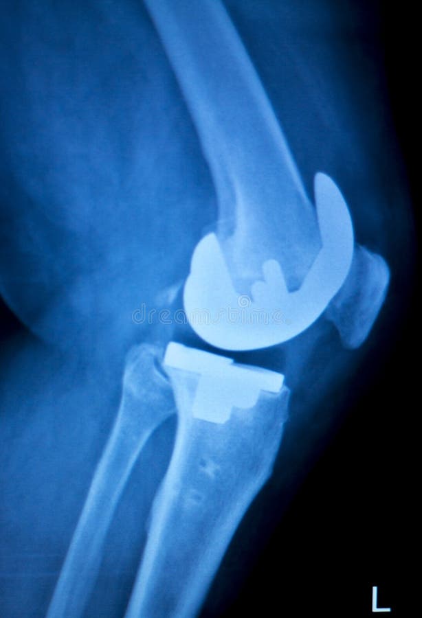 Joint and Bone Health